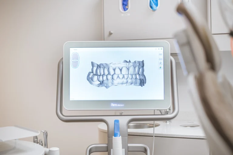 itero 3D teeth scanner